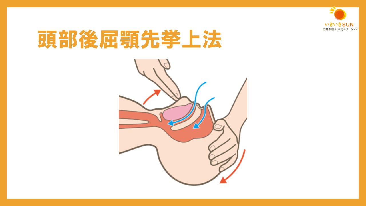 意識障害が見られる利用者のアセスメントポイントと気を付けることは？【訪問看護】