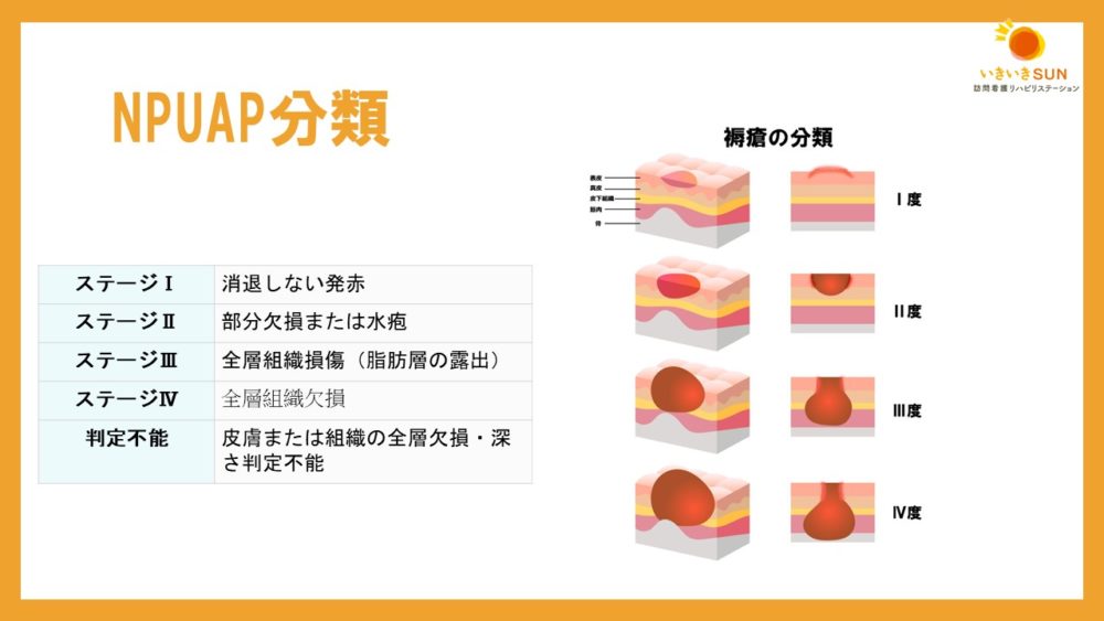 No.42334 Re: 後頭部の褥瘡について : 創傷・褥瘡・熱傷ガ – QROJHB